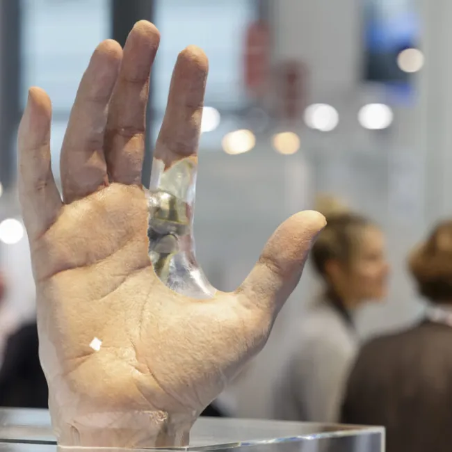 COMPAMED Innovation Forum 2024: Pioneering Advancements in Smart Implant Technology