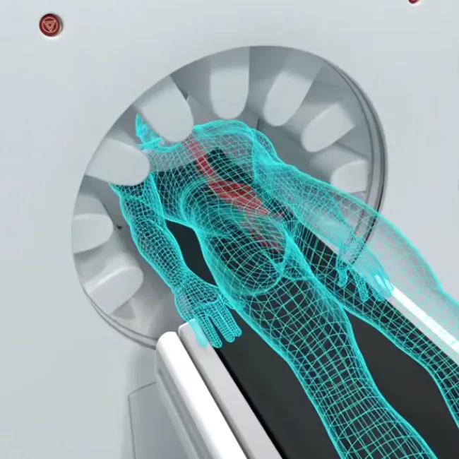 GE HealthCare and University Medicine Essen Join Forces to Revolutionize Cancer Care with New Theranostics Center of Excellence